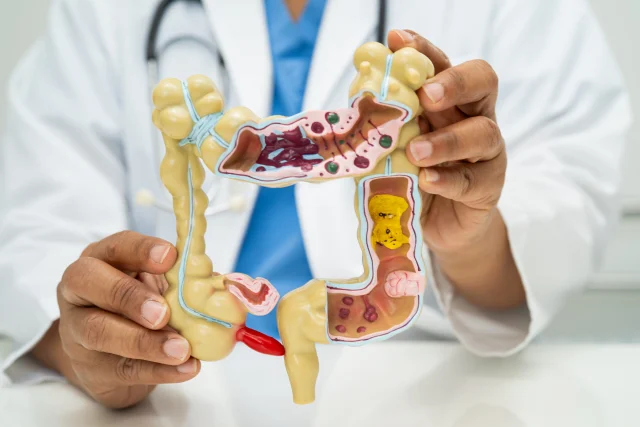 Leaky-Gut-Syndrom: Wenn der Darm "undicht" wird und den Körper vergiftet