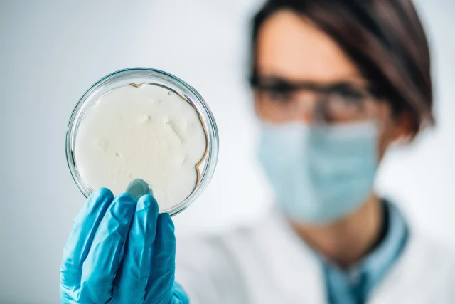Pilze im Darm (Candida): Wenn der Heißhunger auf Süßes nicht aufhört
